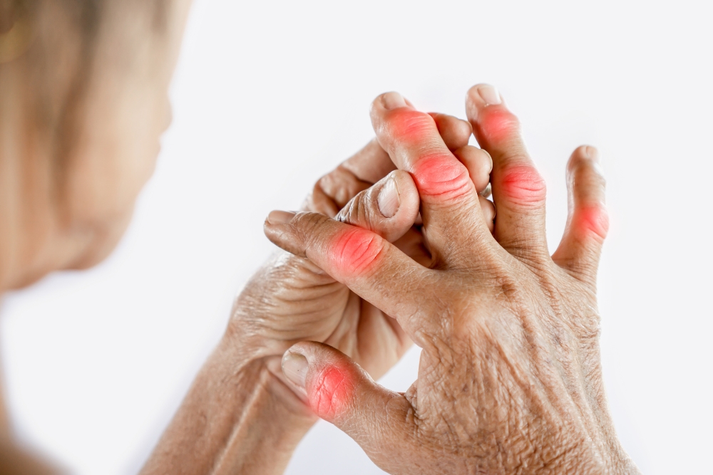 Rheumatoide Arthritis: Symptome, Diagnose und natürliche Linderung