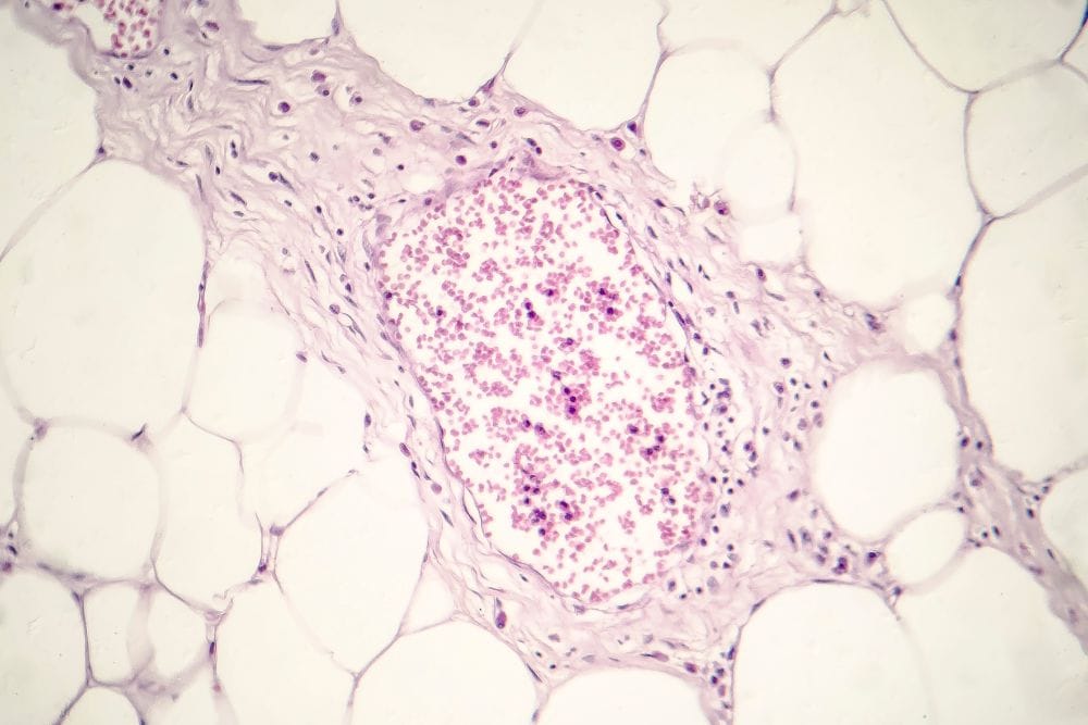 Eine braune Fettzelle unter dem Mikroskop: randvoll mit kleinen Mitochondrien.