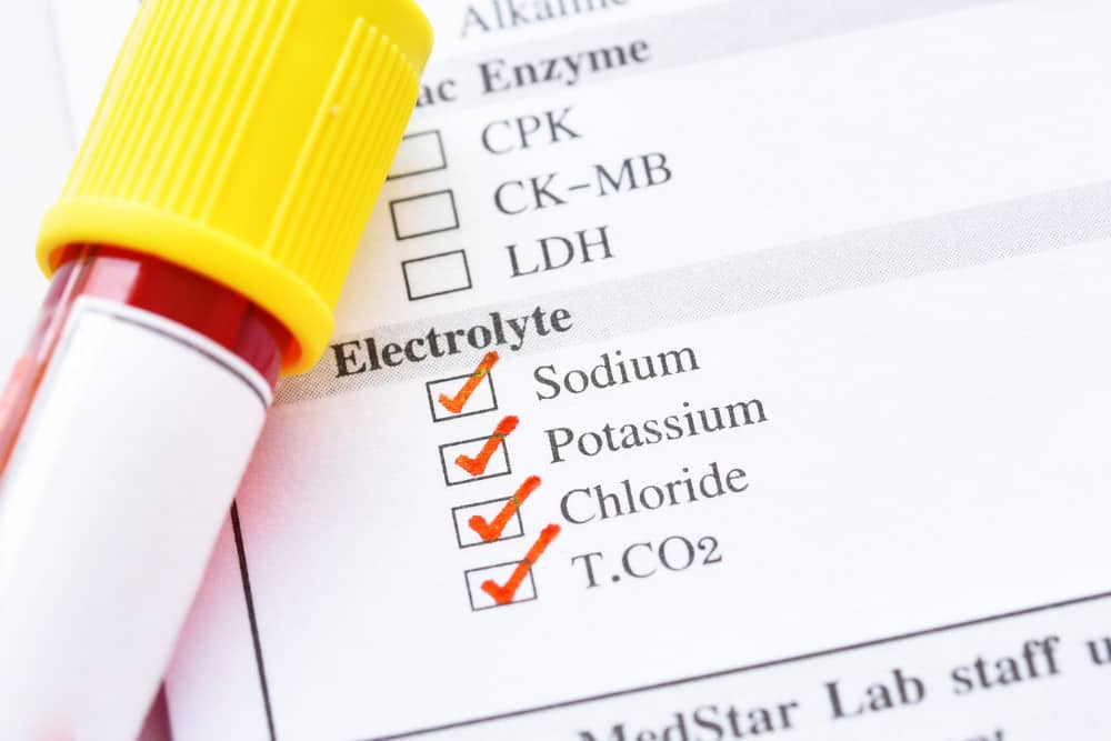 Elektrolyte Test